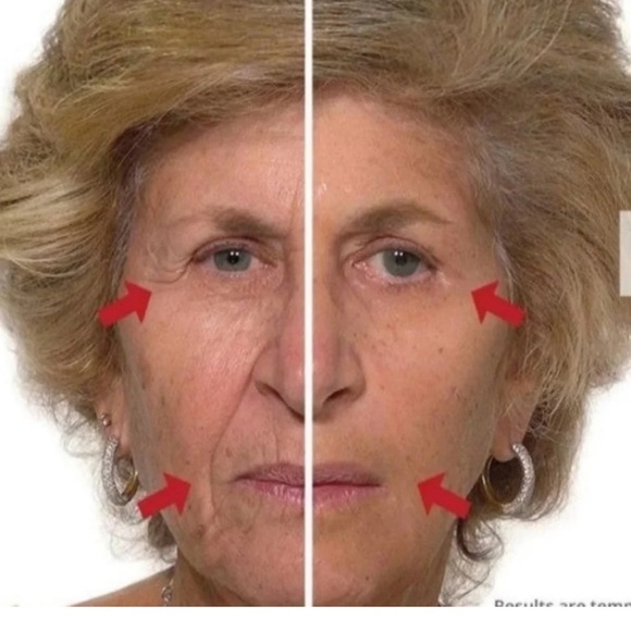 2 Plexaderm Rapid Reduction Advanced Serum AS SEEN ON TV's Best Selling Skincare - Picture 4 of 15